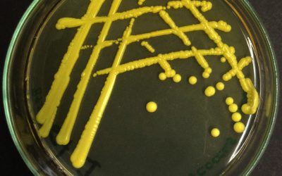 Grundläggande mikrobiologi