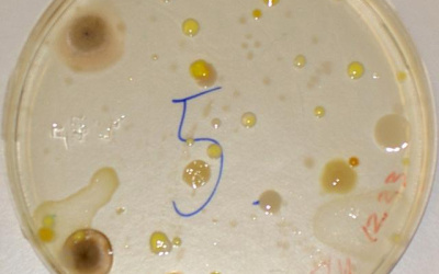 Mikrobiologi