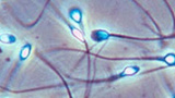 Lesbiska par gör väntan på insemination lång