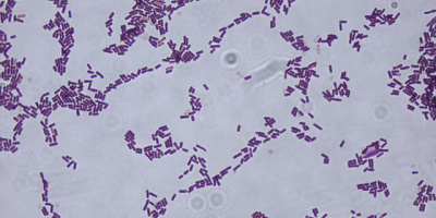 Lösningar till gramfärgning