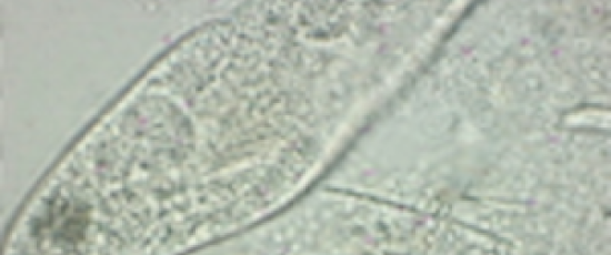 Roterande Paramecium caudatum
