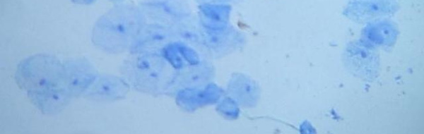Prov 2004-04-28 i Cellbiologi och genteknik, Nv1A