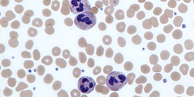 Första och andra försvarsnivån (det icke-specifika immunförsvaret)