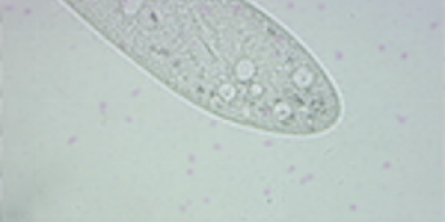 Paramecium caudatum: Kontraktil vakuol