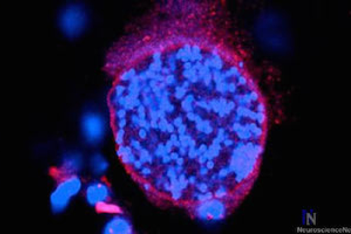 Hjärnparasiten Toxoplasma gondii påverkar hjärnans kemi
