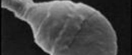 Homunculus