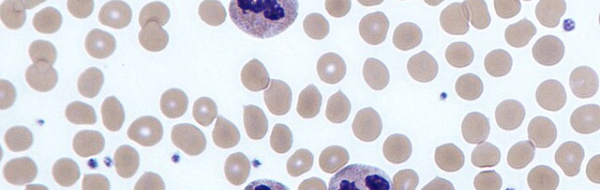 Första och andra försvarsnivån (det icke-specifika immunförsvaret)