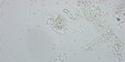 Vorticella äter