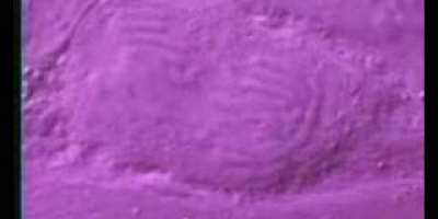 Kromosomer. Hur gener uttrycks