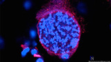 Hjärnparasiten Toxoplasma gondii påverkar hjärnans kemi