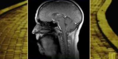 Hur det ser ut inne i huvudet när man sjunger