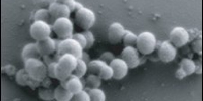 Några frågor och svar om den syntetiska bakterien