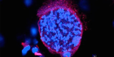 Hjärnparasiten Toxoplasma gondii påverkar hjärnans kemi