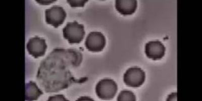 En vit blodkropp som äter en bakterie