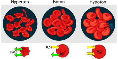 Vattenbalans och njurar
