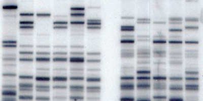 DNA fingerprinting