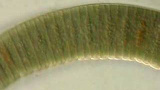 Vackra cyanobakterier
