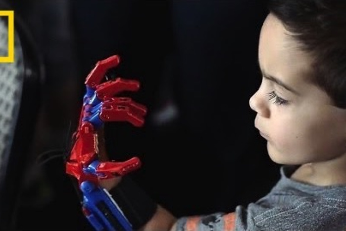 3D-printade proteser ändrar barnens liv