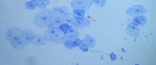 Avd. f. biologiska babblerier del 10: Cellfie