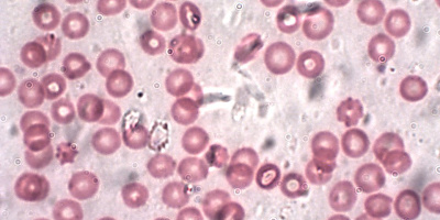 Blodets sammansättning