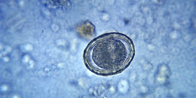 Stamceller och andra cellinjer