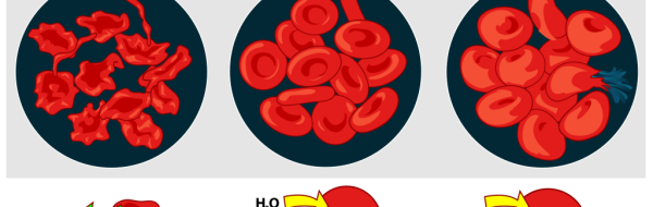 Vattenbalans och njurar