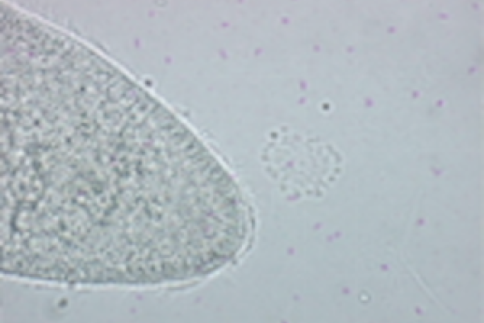 Paramecium caudatum