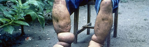 Blod, vävnadsvätska och lymfa