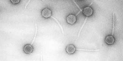 Klyvning av λ-DNA med restriktions­enzymer