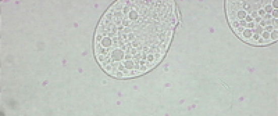 Tetrahymena thermophila