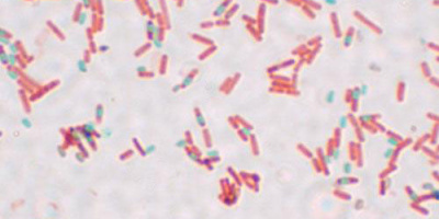 Bakteriecellens uppbyggnad