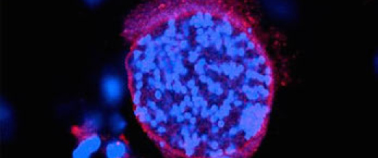Hjärnparasiten Toxoplasma gondii påverkar hjärnans kemi