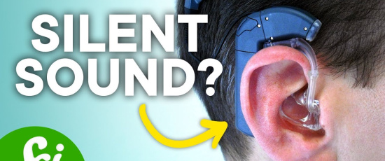 Hur låter cochleaimplantat?