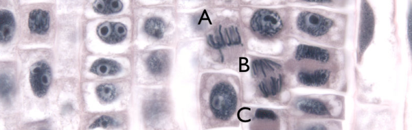Övningsuppgifter, Biologi nivå 1: Cellgenetik