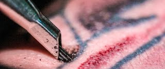 Tatuering i ultrarapid