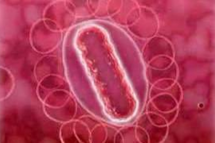 Hur smittar Legionella?