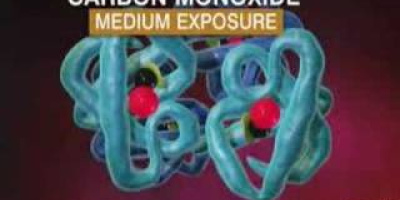 Kolmonoxid-förgiftning