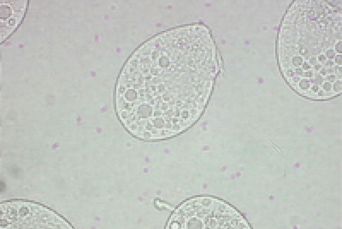 Tetrahymena thermophila