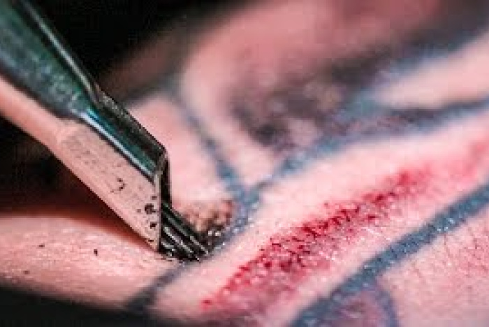 Tatuering i ultrarapid