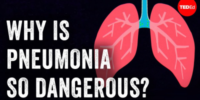 Varför är lunginflammation så farligt?