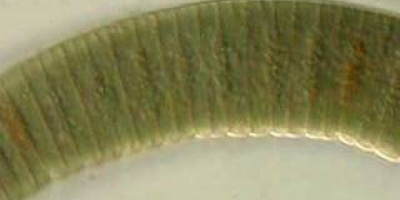 Vackra cyanobakterier