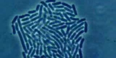 Bakteriers utseende och släktskap. Mikrosvampar. Bakteriell tillväxt.