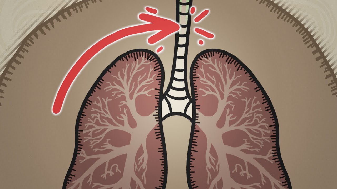 Lungornas fatala fel