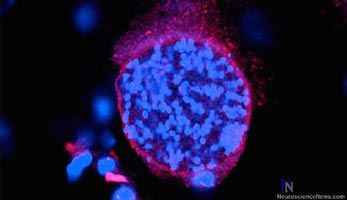 Hjärnparasiten Toxoplasma gondii påverkar hjärnans kemi