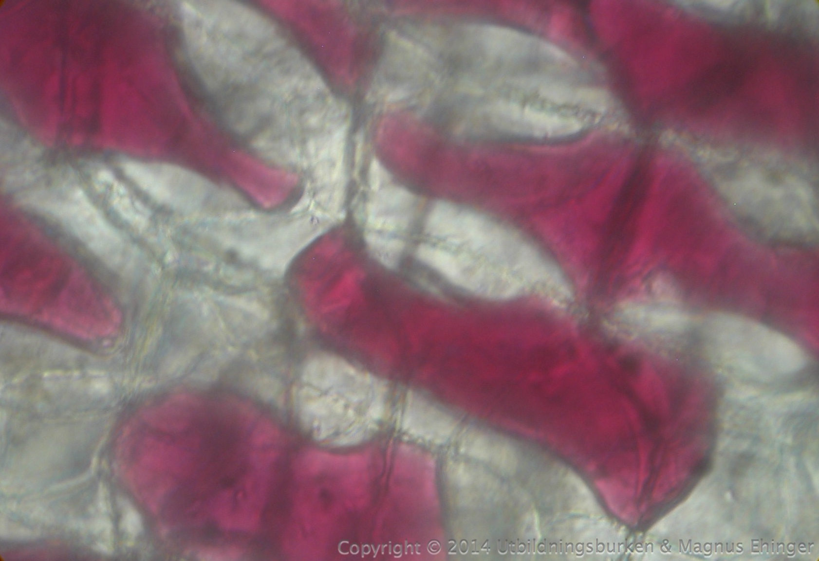 Lökceller i hyperton lösning.