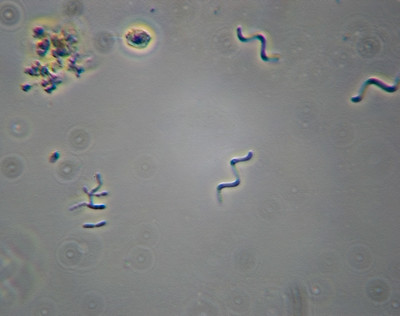 Spiriller i vattenprov.